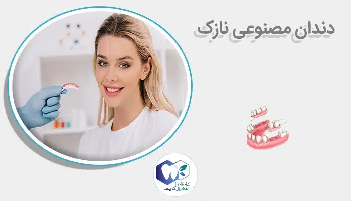 دندان مصنوعی نازک
