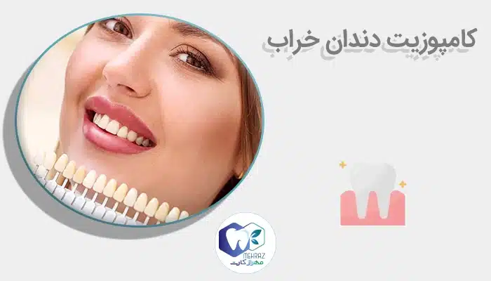 کامپوزیت دندان خراب