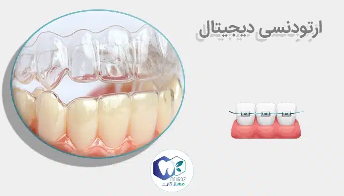 ارتودنسی دیجیتال