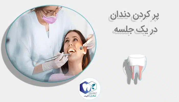 پر کردن دندان در یک جلسه