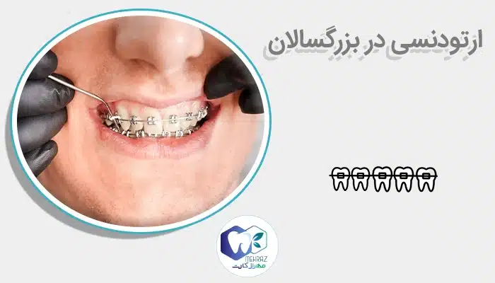 ارتودنسی در بزرگسالان