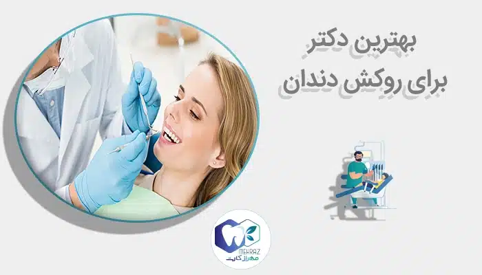 بهترین دکتر برای روکش دندان