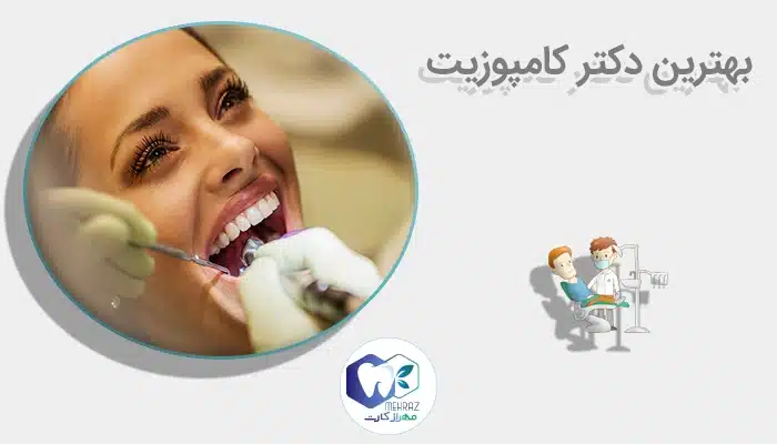 بهترین دکتر کامپوزیت