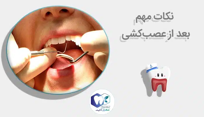 نکات مهم بعد از عصبکشی