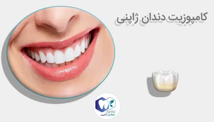 کامپوزیت دندان ژاپنی