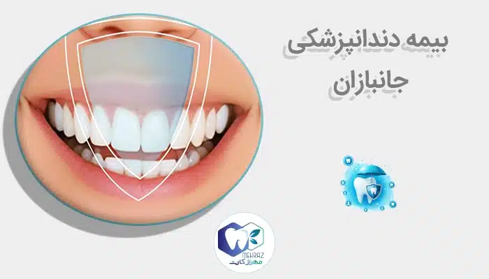 بیمه دندانپزشکی جانبازان