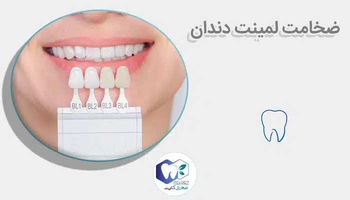 ضخامت لمینت دندان
