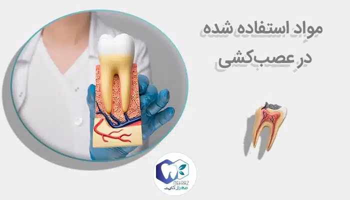 مواد استفاده شده در عصبکشی