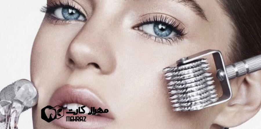 میکرونیدلینگ | تخفیف