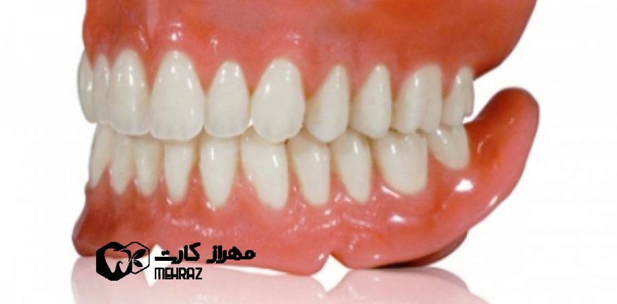 پروتز دست دندان کامل