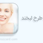 اصلاح طرح لبخند