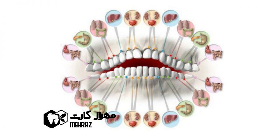 دندان درد و اختلال در بدن