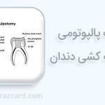 تفاوت پالپوتومی با عصب کشی دندان