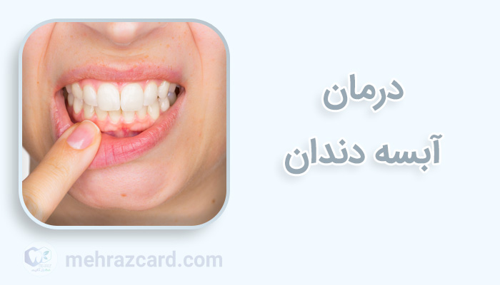آبسه دندان | درمان آبسه دندان