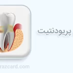 پریودنتیت