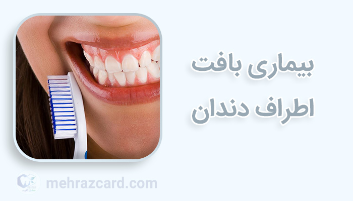 بیماری بافت اطراف دندان