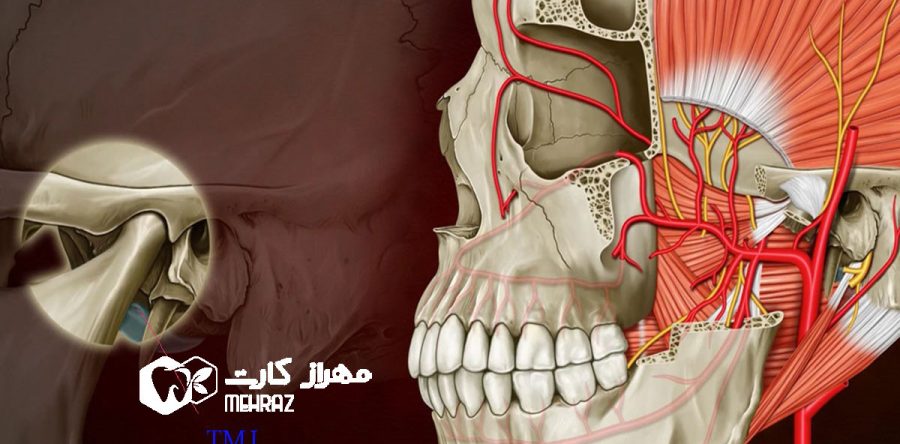 اختلال مفصل گیجگاهی | سندرم مفصل فک