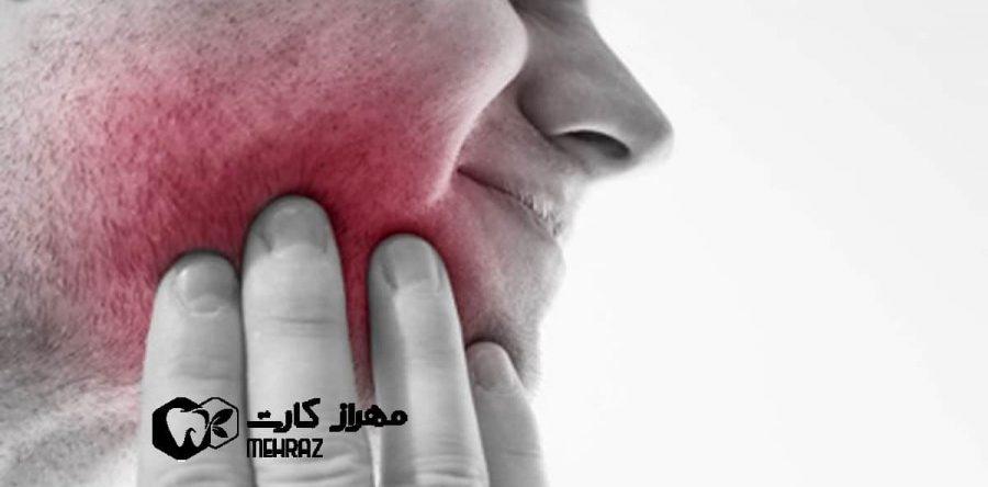 دندان درد عصبی | درمان