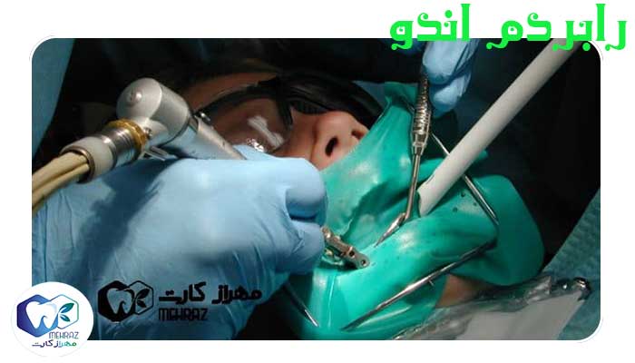 رابردم اندو ✅ رابردم دندانپزشکی