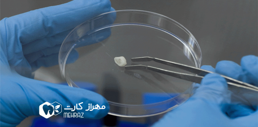 استفاده از سلول های بنیادی توسط دندان ها