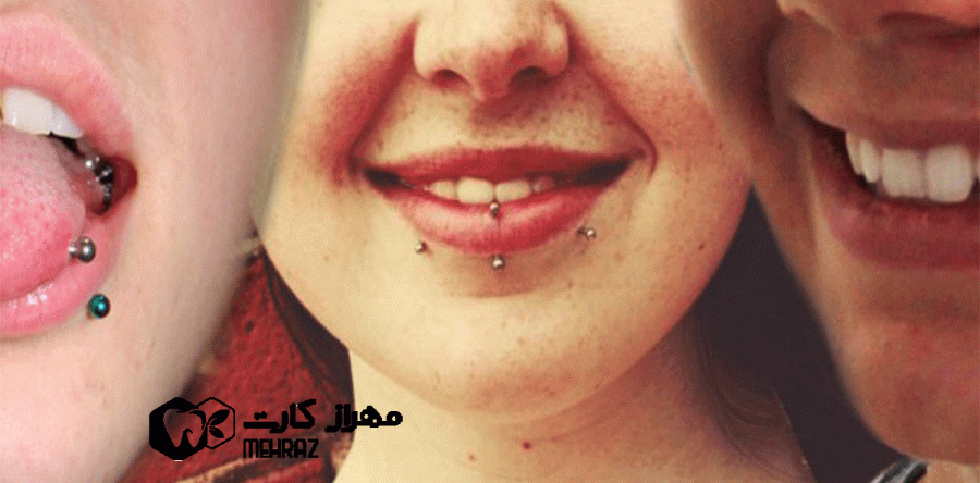 ملاحظات دندانپزشکی پیرسینگ لب و دهان