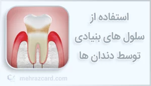 استفاده از سلول های بنیادی توسط دندان ها