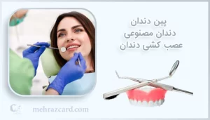 پین دندان | دندان مصنوعی | عصب کشی دندان