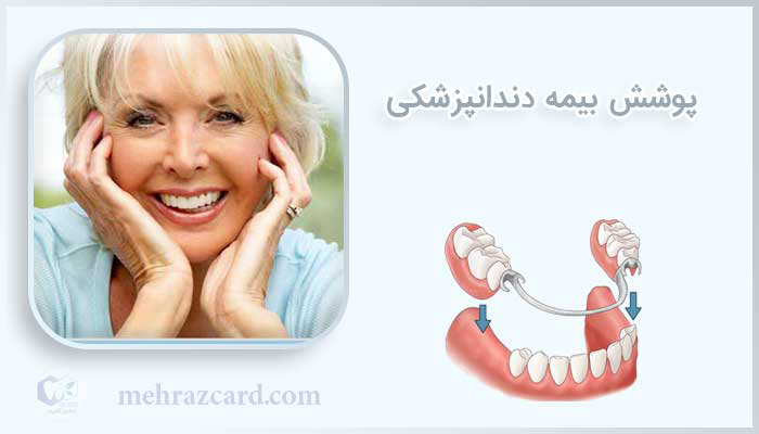 پوشش بیمه دندانپزشکی