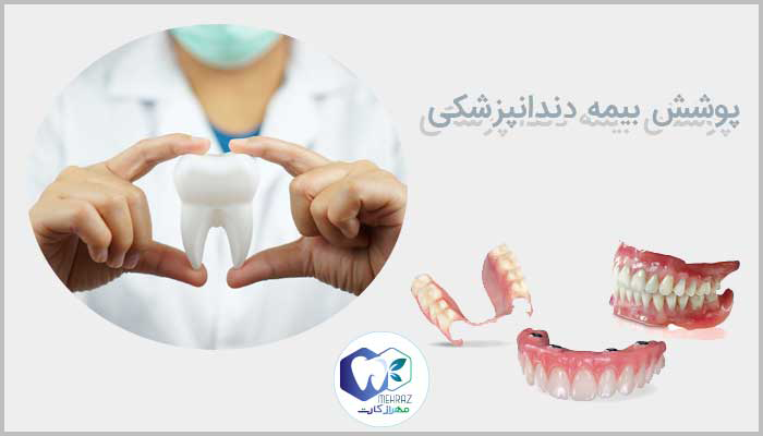 پوشش بیمه دندانپزشکی