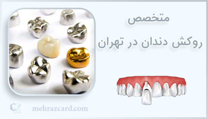 متخصص روکش دندان در تهران