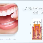 خرید بیمه دندانپزشکی رشت