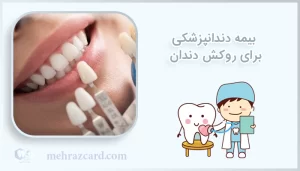 بیمه دندانپزشکی برای روکش دندان