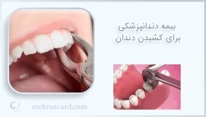 بیمه دندانپزشکی برای کشیدن دندان