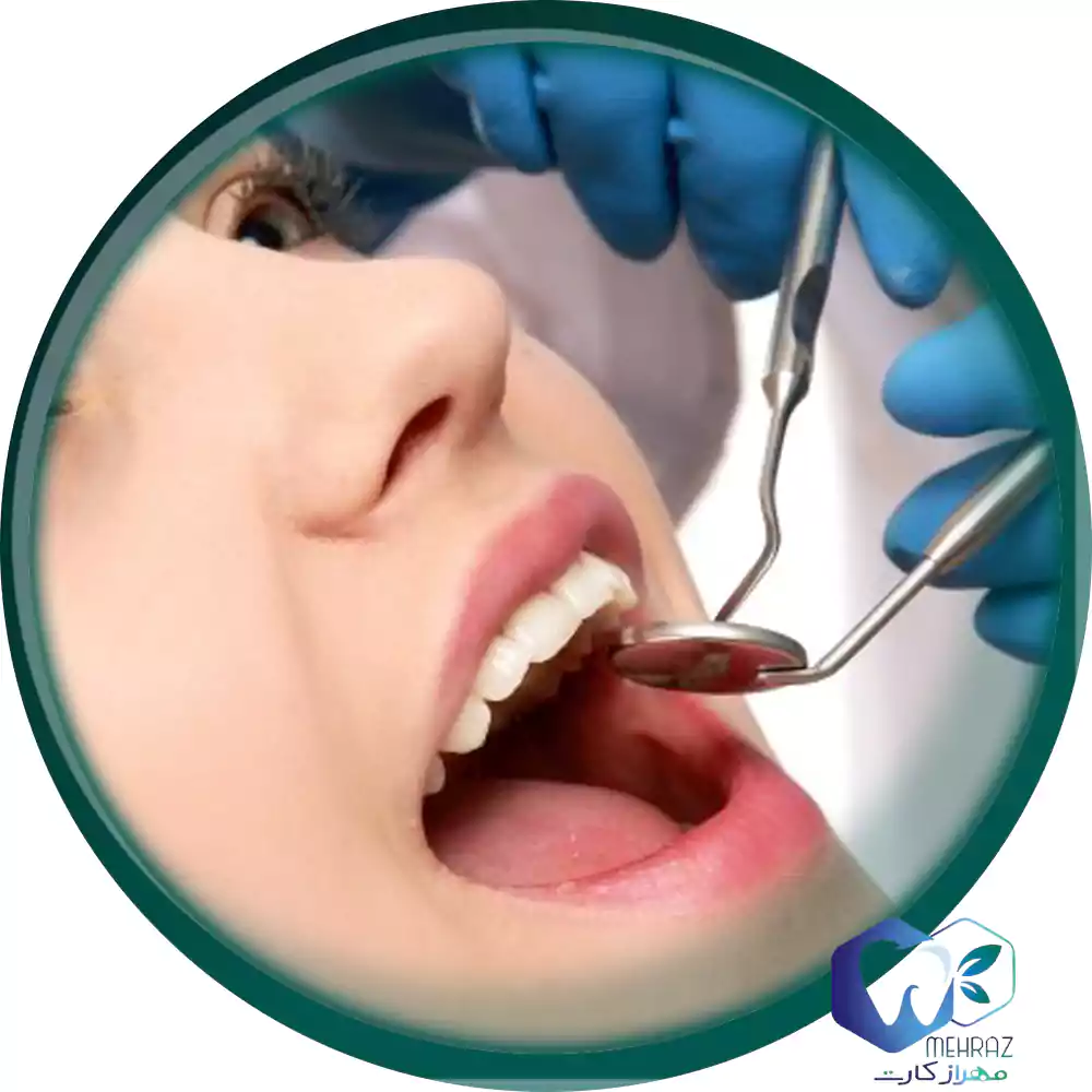 جراحی تخصصی دندان با آخرین قیمت خدمات دندانپزشکی