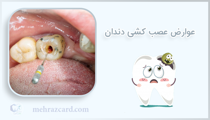 عوارض-عصب-کشی-دندان