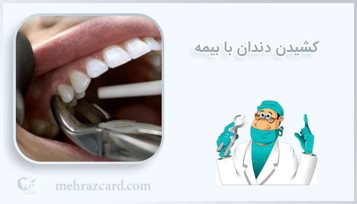 کشیدن دندان با بیمه