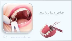 جراحی دندان با بیمه