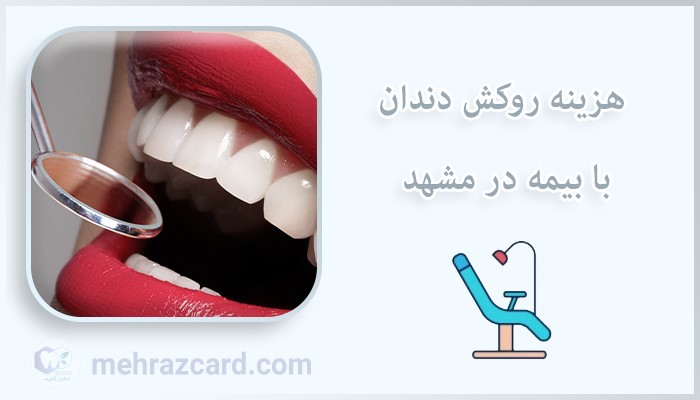 هزینه روکش دندان با بیمه در مشهد