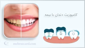 کامپوزیت دندان با بیمه