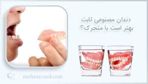 دندان مصنوعی ثابت بهتر است یا متحرک؟