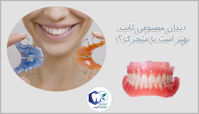 دندان مصنوعی ثابت بهتر است یا متحرک؟