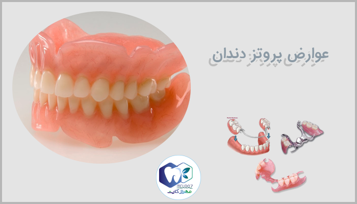 عوارض پروتز دندان
