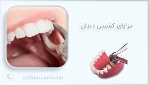 مزایای کشیدن دندان