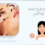 اصلاح طرح لبخند با بوتاکس