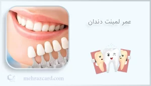 عمر لامینت دندان