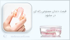 قیمت دندان مصنوعی ژله ای در مشهد