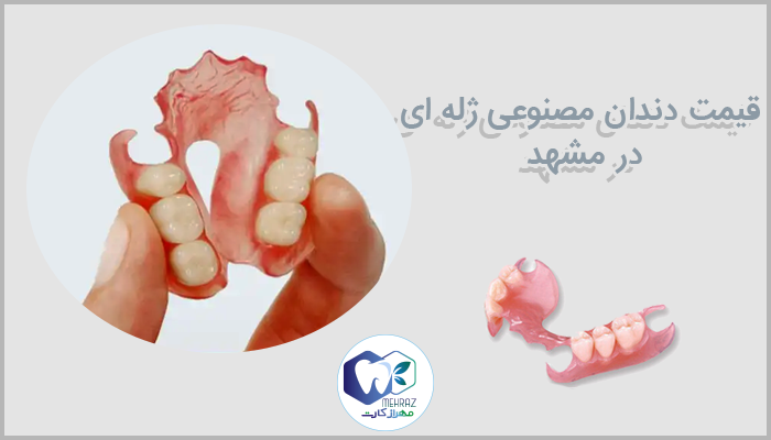 قیمت دندان مصنوعی ژله ای در مشهد
