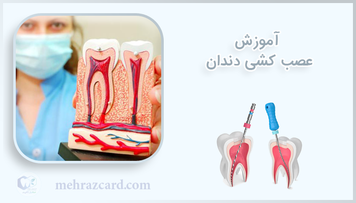 آموزش عصب کشی دندان