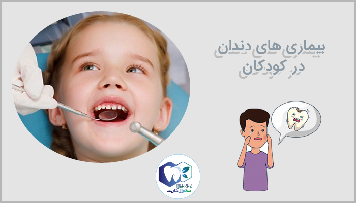 بیماری های دندان در کودکان