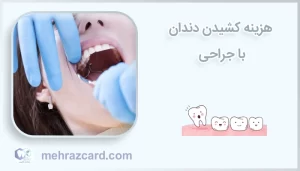 هزینه کشیدن دندان با جراحی